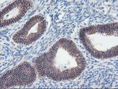 Immunohistochemistry-Paraffin: 15-Lipoxygenase 1 Antibody (OTI3G8) [NBP2-01740]