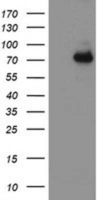 Western Blot: 15-Lipoxygenase 1 Antibody (OTI3G8) [NBP2-01740]