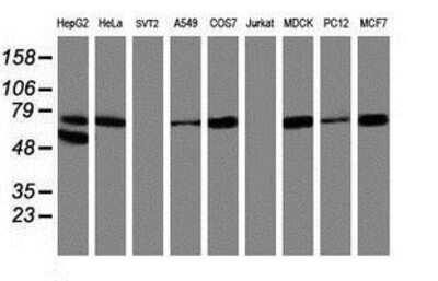 Western Blot: 15-Lipoxygenase 1 Antibody (OTI3G8) [NBP2-01740]
