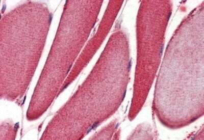Immunohistochemistry-Paraffin: 15-Lipoxygenase 1 Antibody [NBP1-06976]
