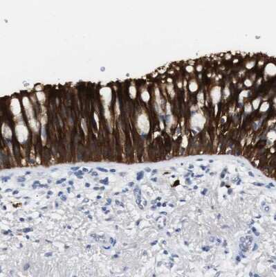 Immunohistochemistry-Paraffin: 15-Lipoxygenase 1 Antibody [NBP1-90336]