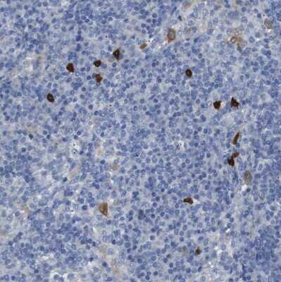 Immunohistochemistry-Paraffin: 15-Lipoxygenase 1 Antibody [NBP1-90336]