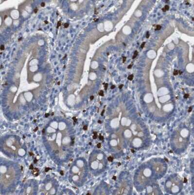 Immunohistochemistry-Paraffin: 15-Lipoxygenase 1 Antibody [NBP1-90336]