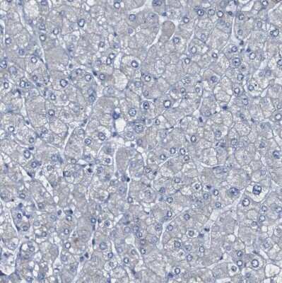 Immunohistochemistry-Paraffin: 15-Lipoxygenase 1 Antibody [NBP1-90336]