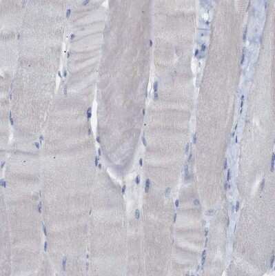 Immunohistochemistry-Paraffin: 15-Lipoxygenase 1 Antibody [NBP1-90336]