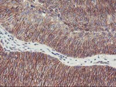 Immunohistochemistry: 15-Lipoxygenase 1 Antibody (OTI3G8) - Azide and BSA Free [NBP2-70169]
