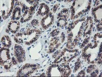 Immunohistochemistry: 15-Lipoxygenase 1 Antibody (OTI3G8) - Azide and BSA Free [NBP2-70169]