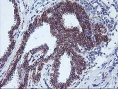 Immunohistochemistry: 15-Lipoxygenase 1 Antibody (OTI3G8) - Azide and BSA Free [NBP2-70169]