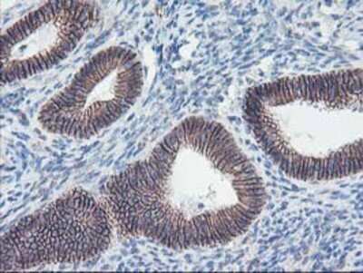 Immunohistochemistry: 15-Lipoxygenase 1 Antibody (OTI3G8) - Azide and BSA Free [NBP2-70169]