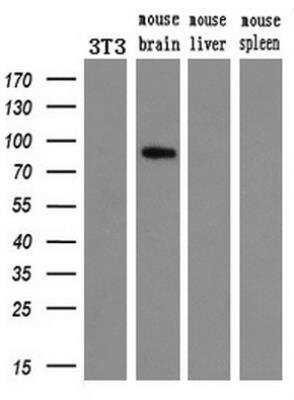 Western Blot: 15-Lipoxygenase 1 Antibody (OTI3G8) [NBP2-01740]