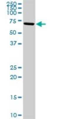 Western Blot: 15-Lipoxygenase 1 Antibody [H00000246-D01P]