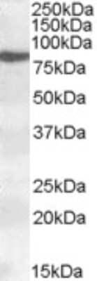 Western Blot: 15-Lipoxygenase 1 Antibody [NBP1-06976]