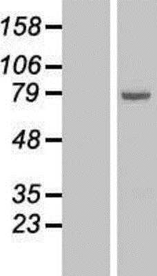 Western Blot: 15-Lipoxygenase 1 Overexpression Lysate [NBL1-07481]