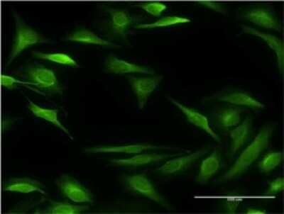 Immunocytochemistry/ Immunofluorescence: 15-Lipoxygenase 2 Antibody (4A7) [H00000247-M05]