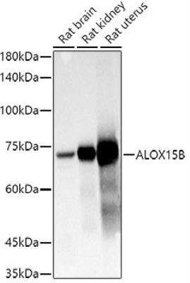 Western Blot: 15-Lipoxygenase 2 AntibodyAzide and BSA Free [NBP2-92668]