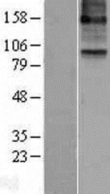 Western Blot: 15-Lipoxygenase 2 Overexpression Lysate [NBL1-07482]