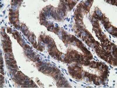 Immunohistochemistry-Paraffin: 15-PGDH/HPGD Antibody (OTI2C10) [NBP2-00490]