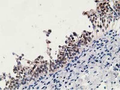 Immunohistochemistry-Paraffin: 15-PGDH/HPGD Antibody (OTI2C10) [NBP2-00490]