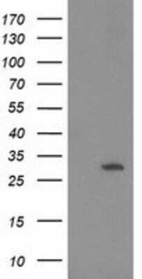 Western Blot: 15-PGDH/HPGD Antibody (OTI2C10) [NBP2-00490]