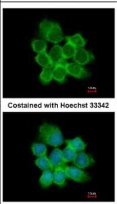 15-PGDH/HPGD Antibody (NBP2-21588) | Bio-Techne