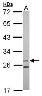 Western Blot: 15-PGDH/HPGD Antibody [NBP2-21588]