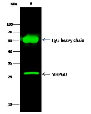 Immunoprecipitation: 15-PGDH/HPGD Antibody (101) [NBP2-90625]