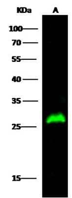 Western Blot: 15-PGDH/HPGD Antibody (101) [NBP2-90625]