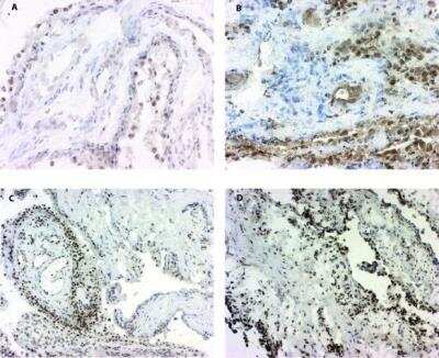 Immunohistochemistry: 15-PGDH/HPGD Antibody [NB200-179]