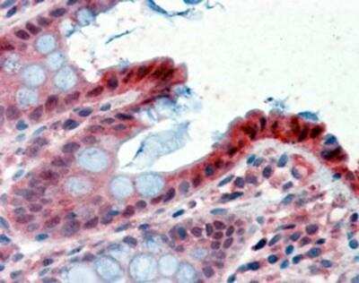 Immunohistochemistry-Paraffin: 15-PGDH/HPGD Antibody [NB100-1482]