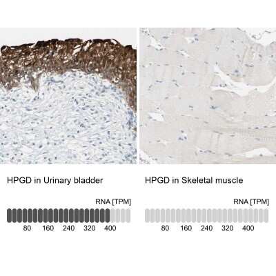 Immunohistochemistry-Paraffin: 15-PGDH/HPGD Antibody [NBP1-87061]
