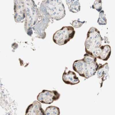 Immunohistochemistry-Paraffin: 15-PGDH/HPGD Antibody [NBP1-87061]