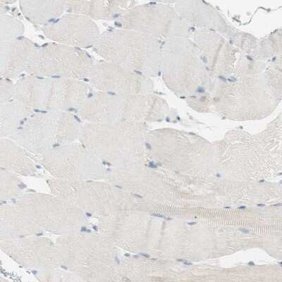 Immunohistochemistry-Paraffin: 15-PGDH/HPGD Antibody [NBP1-87061]