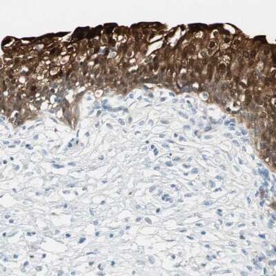 Immunohistochemistry-Paraffin: 15-PGDH/HPGD Antibody [NBP1-87061]