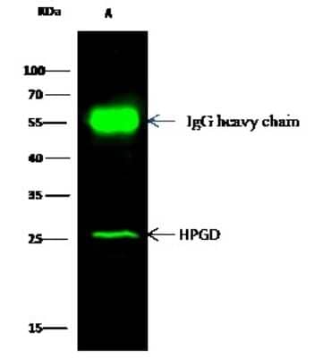 Immunoprecipitation: 15-PGDH/HPGD Antibody [NBP2-98291]