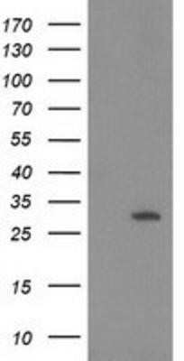 Western Blot: 15-PGDH/HPGD Antibody (OTI2C10)Azide and BSA Free [NBP2-70933]