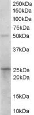 Western Blot: 15-PGDH/HPGD Antibody [NB100-1482]