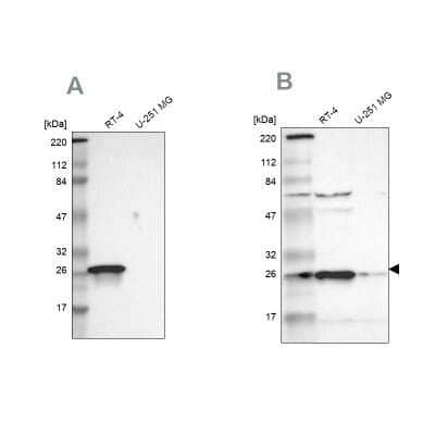 Western Blot: 15-PGDH/HPGD Antibody [NBP1-87061]