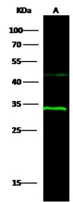 Western Blot: 15-PGDH/HPGD Antibody [NBP2-98291]