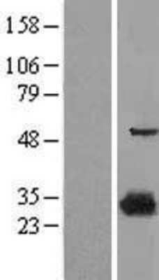 Western Blot: 15-PGDH/HPGD Overexpression Lysate [NBL1-11693]