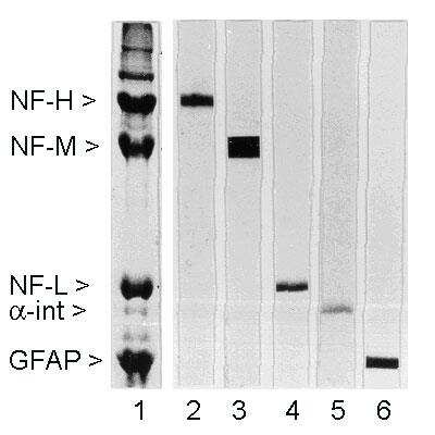 Western Blot: NF-M Antibody (3H11) [NB300-134]