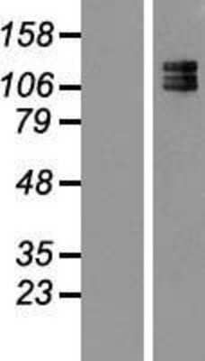 Western Blot: NF-M Overexpression Lysate [NBL1-13578]