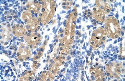 Immunohistochemistry-Paraffin: 17 beta-HSD1/HSD17B1 Antibody [NBP1-56295]