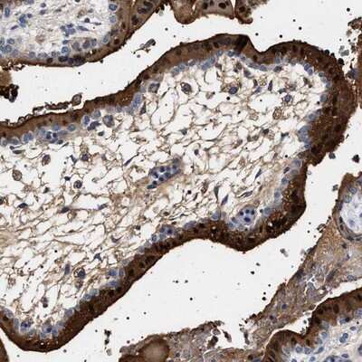 Immunohistochemistry-Paraffin: 17 beta-HSD1/HSD17B1 Antibody [NBP1-84901]