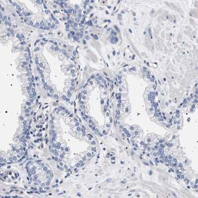 Immunohistochemistry-Paraffin: 17 beta-HSD1/HSD17B1 Antibody [NBP1-84901]