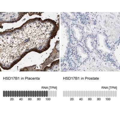 Immunohistochemistry-Paraffin: 17 beta-HSD1/HSD17B1 Antibody [NBP1-84901]