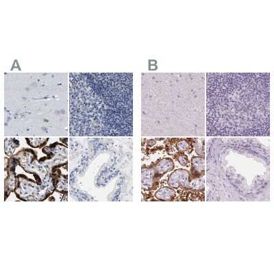Immunohistochemistry-Paraffin: 17 beta-HSD1/HSD17B1 Antibody [NBP1-84901]