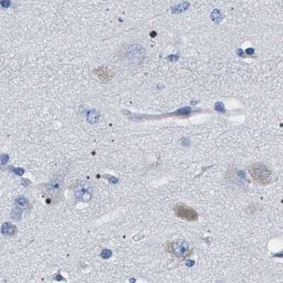 Immunohistochemistry-Paraffin: 17 beta-HSD1/HSD17B1 Antibody [NBP1-84901]