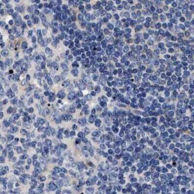 Immunohistochemistry-Paraffin: 17 beta-HSD1/HSD17B1 Antibody [NBP1-84901]