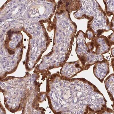Immunohistochemistry-Paraffin: 17 beta-HSD1/HSD17B1 Antibody [NBP2-39053]