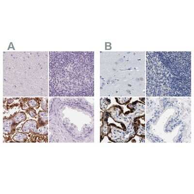 Immunohistochemistry-Paraffin: 17 beta-HSD1/HSD17B1 Antibody [NBP2-39053]